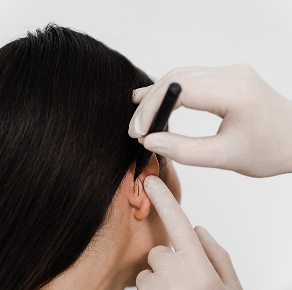 otoplastia en Pamplona y Bilbao