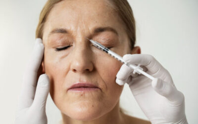 CÓMO PREVENIR LAS ARRUGAS Y LA AYUDA DEL BOTOX