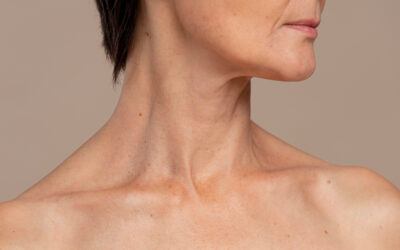 Lifting cervical o lifting de cuello: Diferencias clave y cuál es la mejor opción para ti